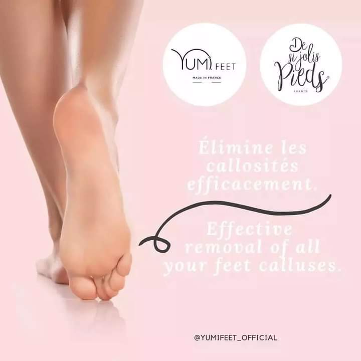 Résultat du traitement Yumi Feet anti-callosités – pieds doux et lisses à Argelès-sur-Mer